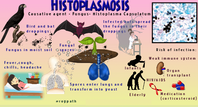 histoplasmacap by bat poop and bird droppings