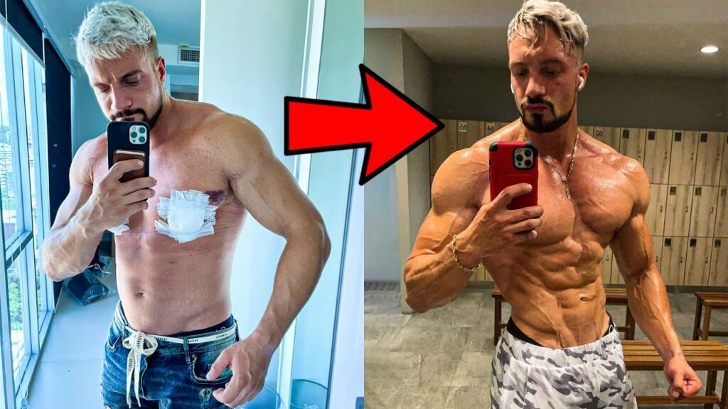Joesthetics took steroids to gain muscles