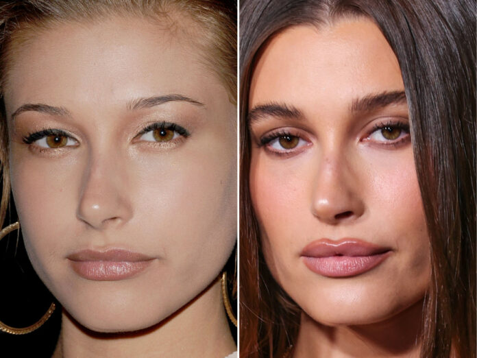 hailey baldwin nose job